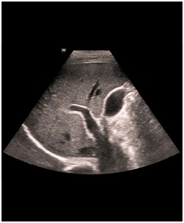 Mindray TE-Air håndholdt ultralyd