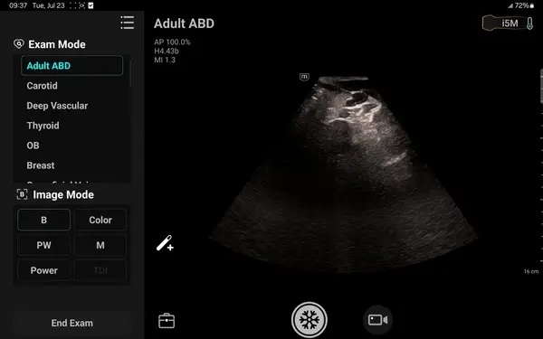 Mindray TE-Air håndholdt ultralyd