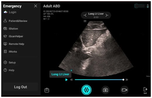 Mindray TE-Air håndholdt ultralyd