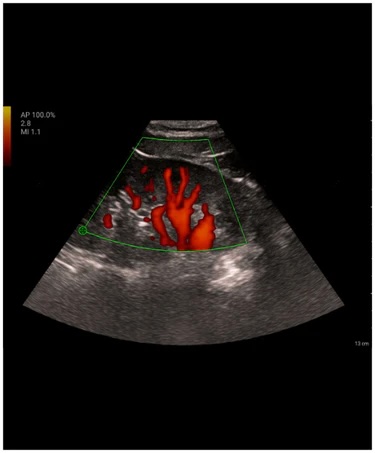 Mindray TE-Air håndholdt ultralyd