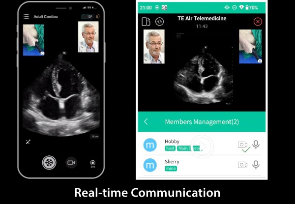 Mindray TE-Air håndholdt ultralyd