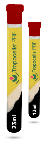 Tropocells®PRF - (Platelet Rich Fibrin)