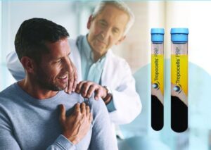 Tropocells®PRP - med separasjonsgel teknologi